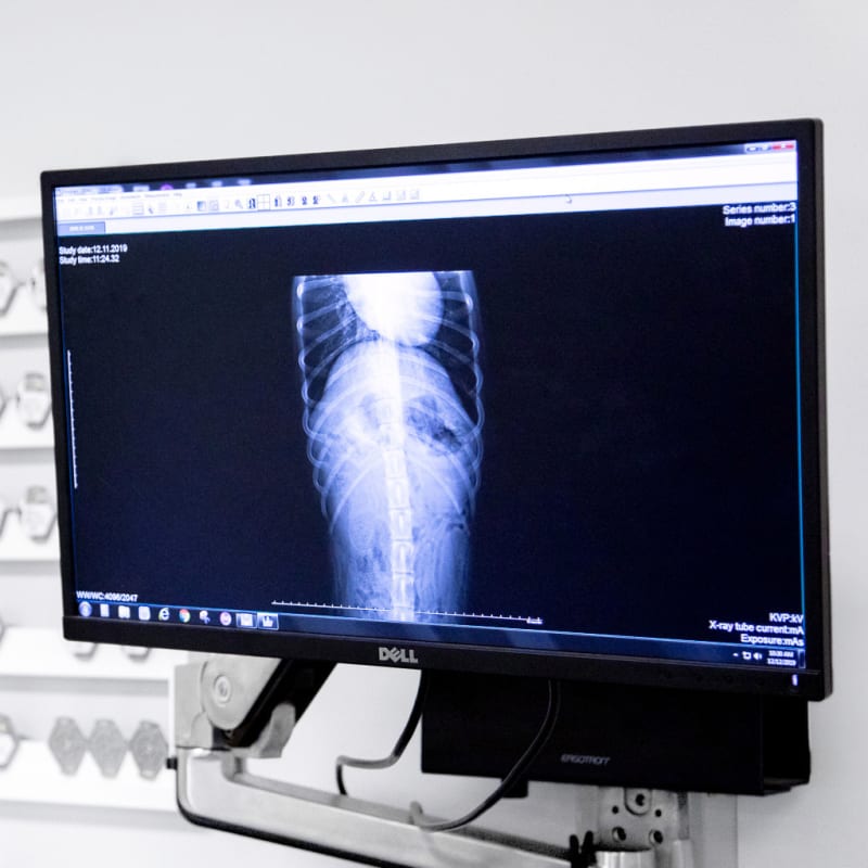 Veterinary Radiology (Digital X-Rays), Meadow Vista Veterinarians
